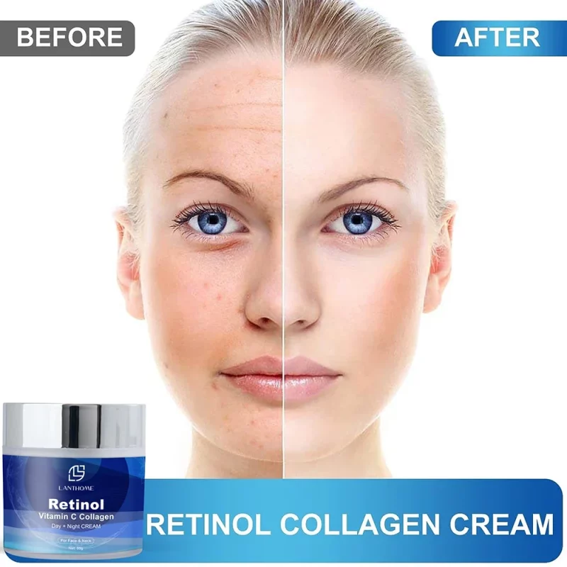 Night and Day Face Whitening Cream results 3